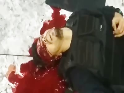 Being Shot in the Eye Might Make you Squirm 