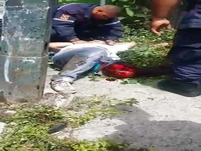 Mans Leg Ripped to Shreds after Terrible Accident 