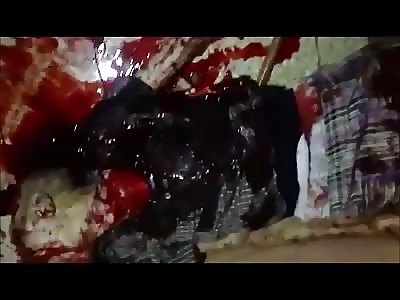 Man Shot Hundreds of Times in the Head is Unrecognizable 