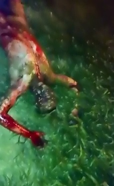 Hard to Watch this Man Suffer from Horrific Burns 