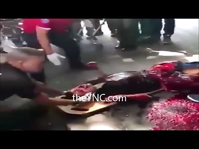 Absolutely Gut Wrenching Video shows Motorcyclist crushed by TRUCK (Still alive) ... he died hours later