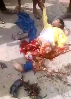 Another SHOCK Video of Boy with no legs Still Alive (Strong Warning)