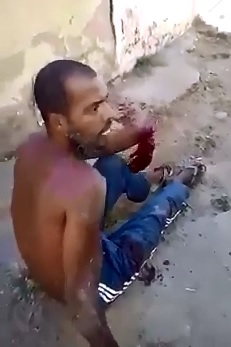 Hanging Hand....I dont think we can Fix That