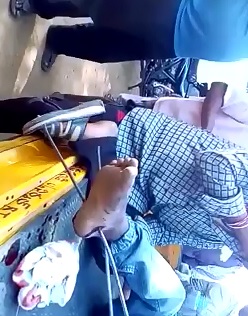 Iron Rods through the Foot is Probably Quite Painful; 