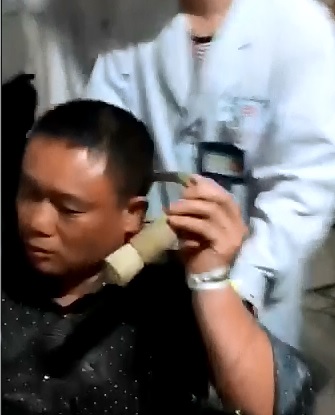 How do you Get a Pitchfork Impaled in your head? 