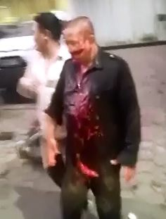 Man Slashed in the Face during Robbery..Aftermath Video shows his Face Post Attack 