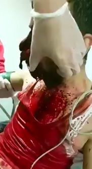 Failed Suicide..Man Anxious after Missing his Brain with Bullet to the head 