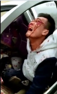 YNC First on Scene:  Man in World of Hell after head on Crash into a Tree 