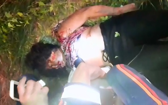 Brazilian Woman found with 16 Bullet holes in Her 