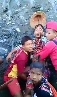 Work Accident.. Man has Iron Rod directly through his Face..Still Alive 