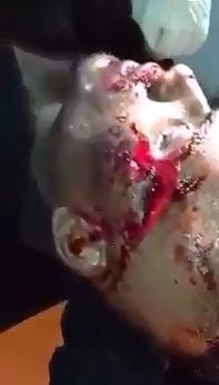 Grunting in Pain..Man still Alive after Vicious Machete Attack (Died Seconds Later) 