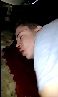 Seconds after Bullet to the Head..Man takes his Final Gasp of Air 