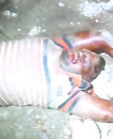 Man Already Swollen Up from Beating to Death Lies Dying 