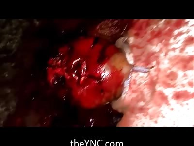 Man with Disgusting Horror Movie Face...Bloated Mess 