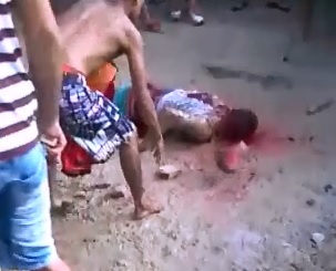 Inmate has his Head Bashed In by Rocks and Stabbed Repeatedly 