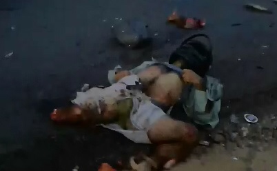 Motorcyclist Legs Ripped Off 