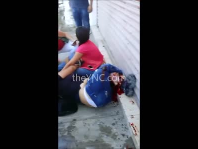 Bad Day?  Not as Bad as this Woman...Look at her Leg 