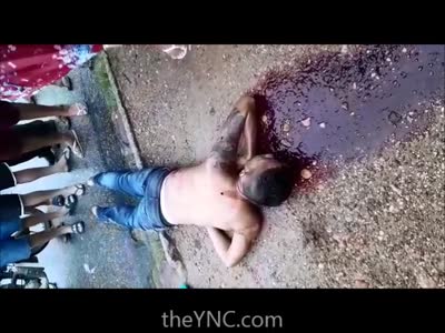 Man Shot in the Back is Vomiting Blood all over the Sidewalk 