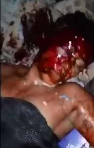 Gruesome Footage shows First hand Woman Struggling to Breath after Stabbing to her Head 