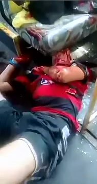 Bus Thief Shot by Passenger Writhes in Agony 