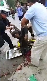 Top Notch Gore only on the YNC...Paramedics Pick up Leg and Torso of Man Killed in Accident 