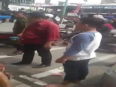 Elderly Man lost his Arm in Gruesome Way..Skin Peeled Off 