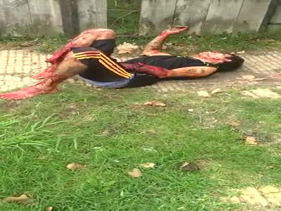 nasty leg destroyed from thief