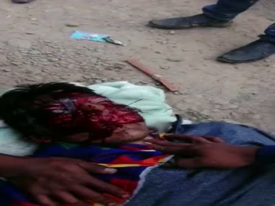 Protester face destroyed by baton round.