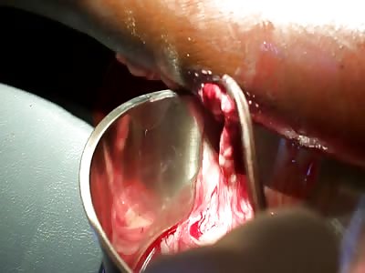 Dr Nasty and the Raspberry Yogurt incident.