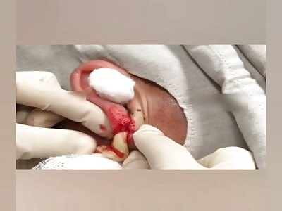 Dr Nasty and the Moomoo makeover.