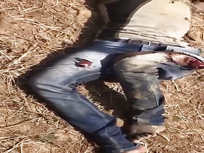 Guy jumps from tower, bones exposed, (full version, better quality).