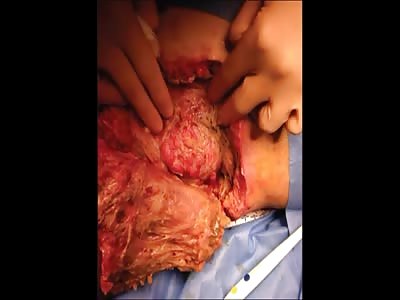 Stars of the YNC #152