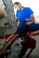 Thug Shot in Femoral Artery Bleeds to Death