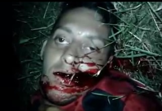 Man Shot in the Mouth Agonizes in Horrific Pain