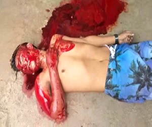 Man Agonizes To Death after Being Shot in Head