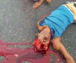 Man Dies With Horrific Death Stare