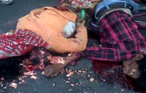 Couple Dies Together With Crushed Head