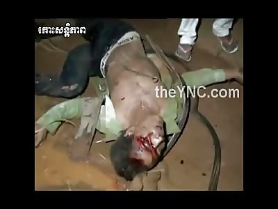 Dude Twisted Up From Accident