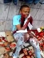 Scared Theif Shot in the Neck Waits for Help While People Say he Must Die