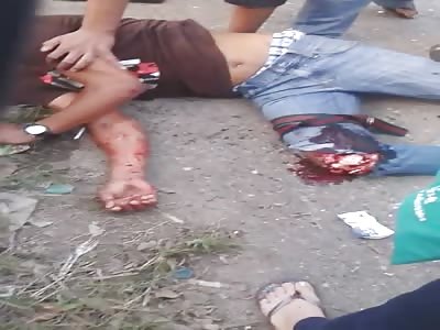 Dude With Knee Cap Ripped Off