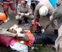 Leg Ripped the Fuck Apart