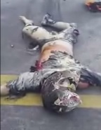 Biker Burned in Horrific Accident STILL Alive in Agony