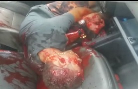 Bloody Mess inside Car Man Shot Several Time