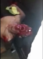 Man Shot in Throat Agonizes to Death.... Trying to Gasp for Air Like a Fish Out of Water