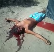 Man agonizing for several minutes before death- Weird Breathing Noises