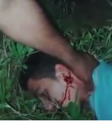 Burglar Beaten then Some Dude Literally Rips his Ear Off