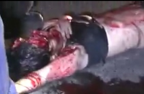 Pretty Woman's Face Horrifically Crushed 