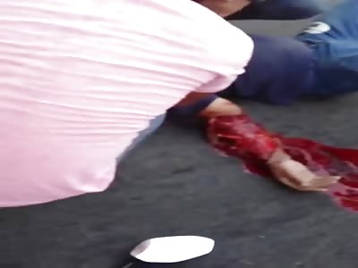 Accident between bike and bus leaves man with forearm skinned