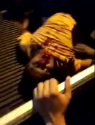 Dude Shot in Face Being Helped by Crowd