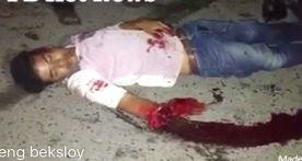 Guy still alive with leg twisted up and forearm ripped apart